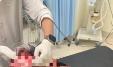 Hà Nội: Khởi tố vụ người đàn ông bị chém đứt cánh tay